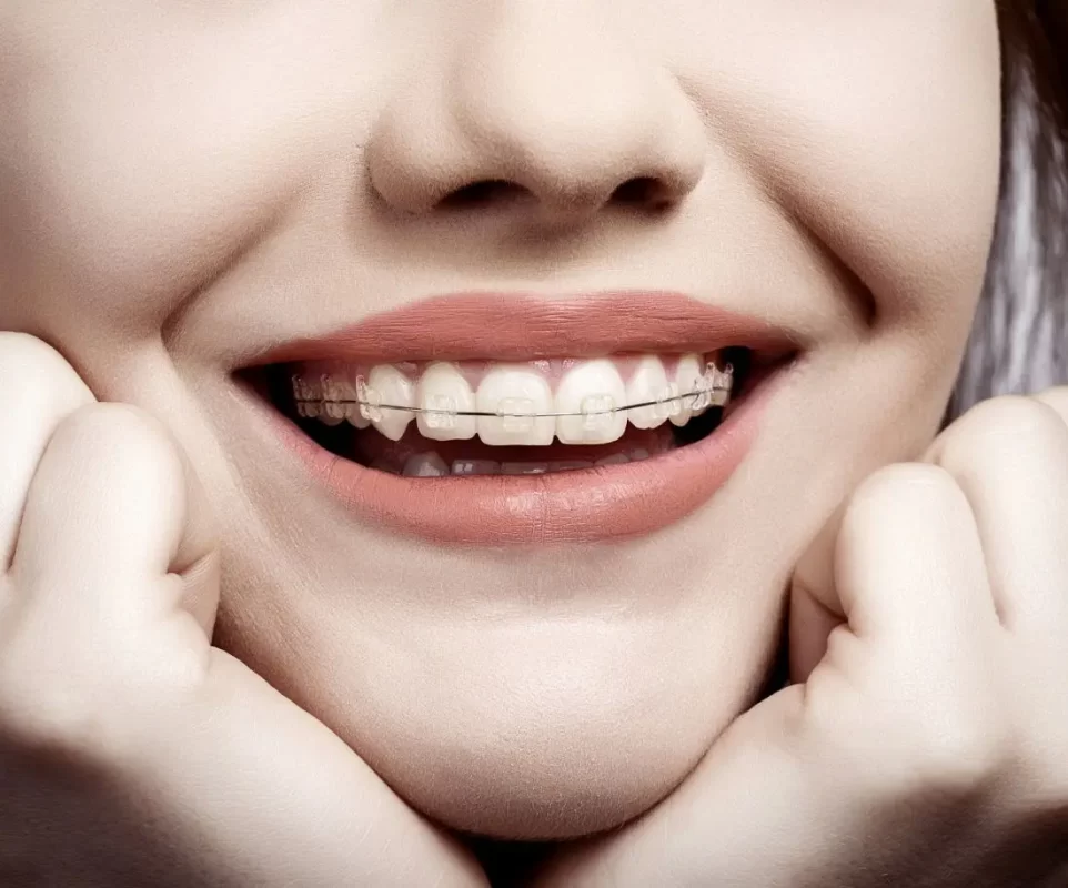 Renove Dente - Ortodontia